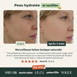 Les effets de l'eau florale Rose de Damas | Bionoble