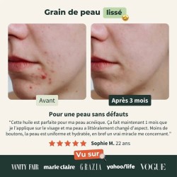 Les résultats de l'Huile de nigelle Bio Bionoble